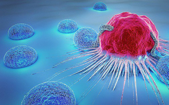 Bệnh Cancer: Nguyên nhân, biến chứng và cách điều trị
